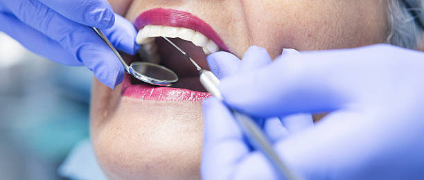 Best Emergency Gum Treatment in Gaffney, SC